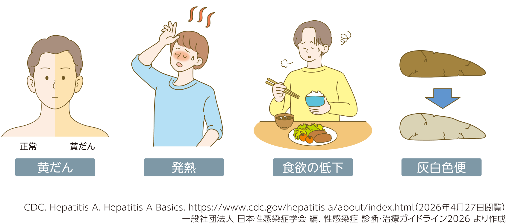 A型肝炎の主な症状。黄だん（皮膚や白目が黄色くなる）、発熱、食欲の低下、便が灰白色に変化する灰白色便。