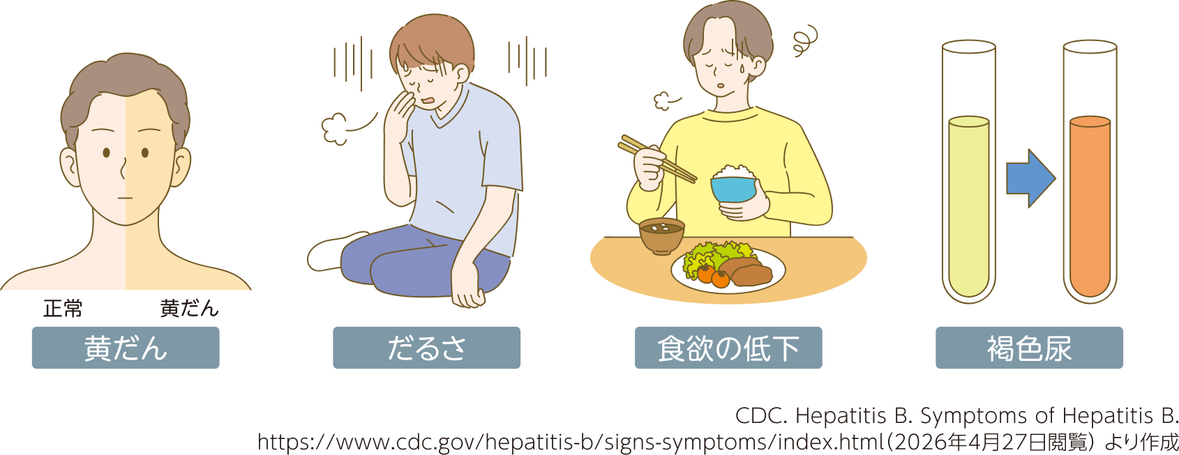 B型肝炎の主な症状。黄だん（皮膚や白目が黄色くなる）、だるさ、食欲の低下、尿が濃い褐色になる褐色尿。