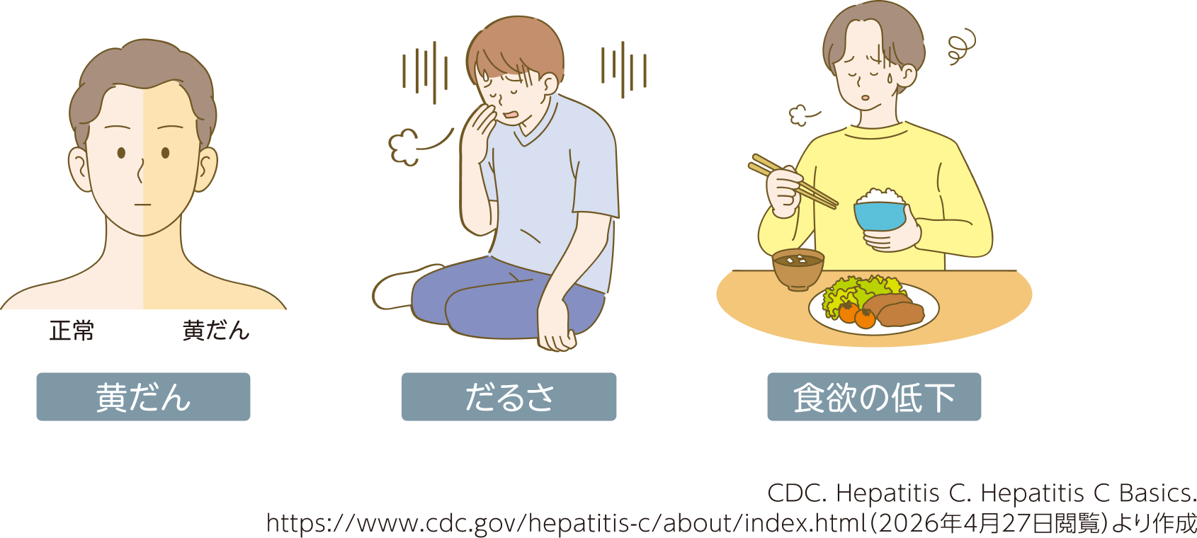 C型肝炎の主な症状。黄だん（皮膚や白目が黄色くなる）、だるさ、食欲の低下。
