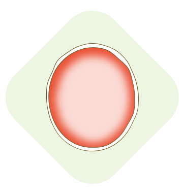 エムポックス